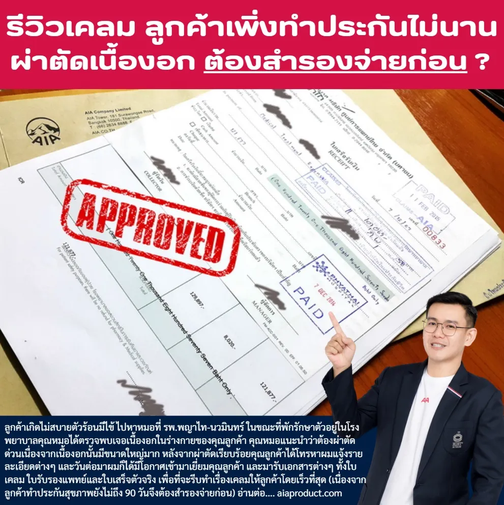 ผ่าตัดเนื้องอกสำรองจ่าย-aia