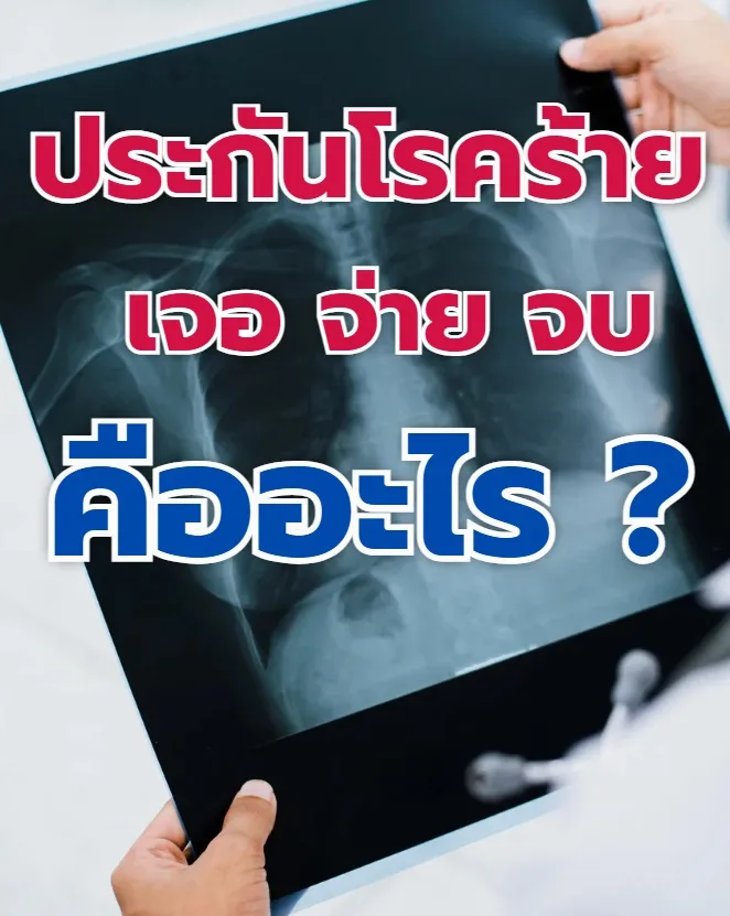 ประกันโรคร้ายแรง เจอจ่ายจบ คืออะไร? ข้อดี-ข้อด้อย ที่ต้องรู้ก่อนตัดสินใจ